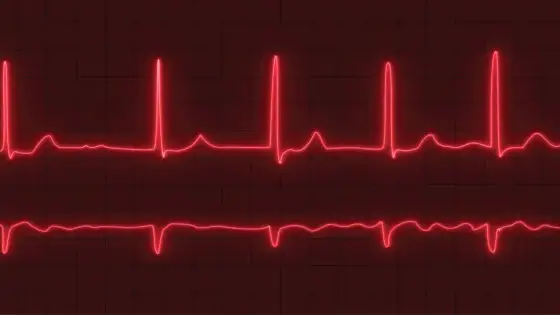 Tachykardia zatokowa - Kiedy szybki puls jest groźny?