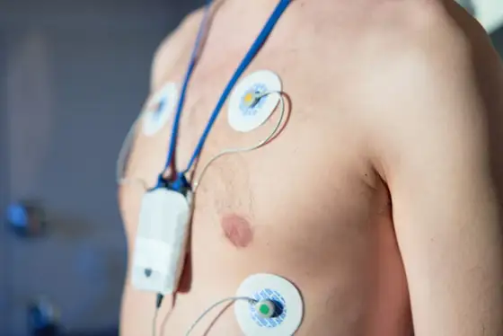 Holter EKG - Kiedy warto go zrobić? Pełny przewodnik