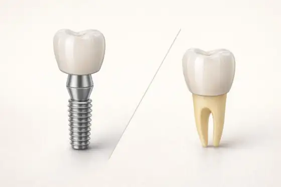 Sztuczny ząb - Co wybrać: implant, koronę czy protezę?