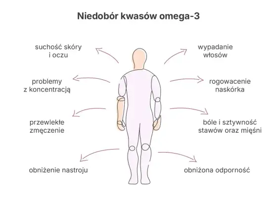 Niedobór omega-3 - objawy, które łatwo przeoczyć