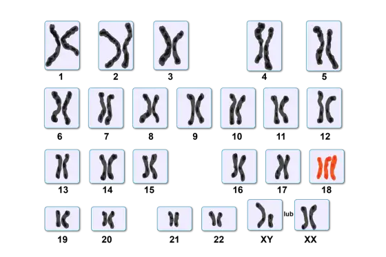 Kariotyp - Jak czytać 46,XX/XY i co wynika z badania?