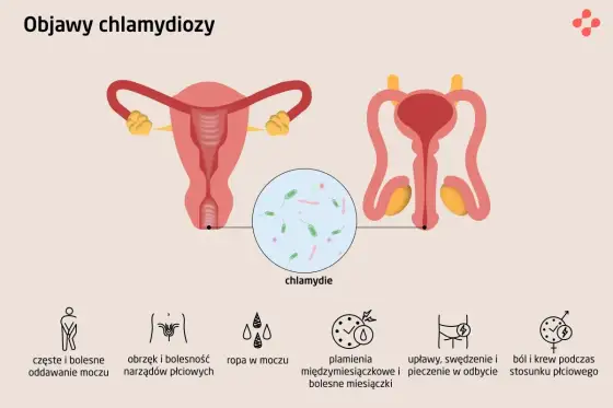 Objawy chlamydii - kiedy testować? Kobiety i mężczyźni