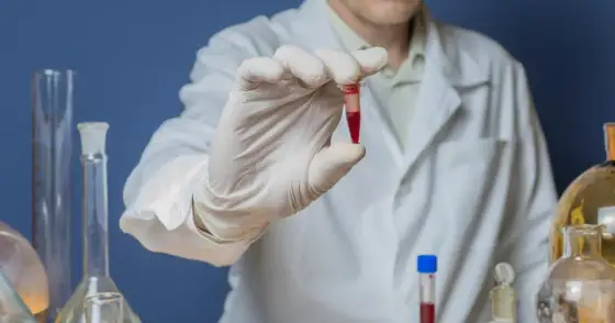 Bilirubina w moczu - co oznacza i kiedy wymaga diagnostyki