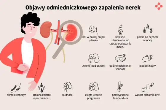 Zapalenie nerek - Objawy, różnice i kiedy do lekarza?