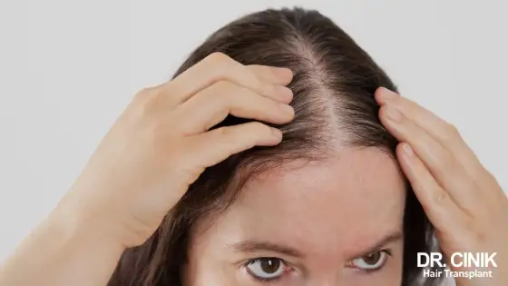 Vitamine D et cheveux - Vraiment utile contre la chute?