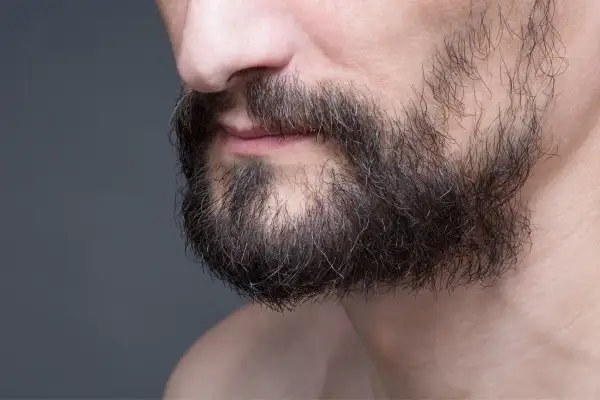 Gros plan sur le menton d'un homme, montrant une barbe foncée et clairsemée. On aperçoit un trou dans la barbe, signe d'une perte de barbe.