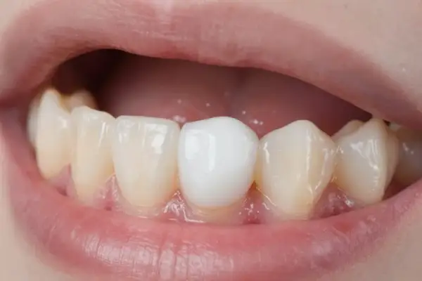 Ból dziąsła: Szybka ulga w domu i kiedy iść do dentysty?