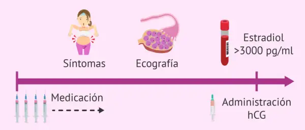 Proceso de donación de óvulos: síntomas, ecografía, medicación, estradiol alto y administración de hCG. A veces, duele donar óvulos.