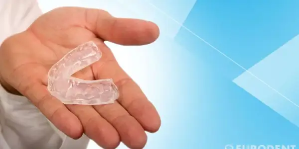 Mano che tiene un bite trasparente. Questo dispositivo, se usato correttamente, può aiutare a correggere la posizione dei denti.