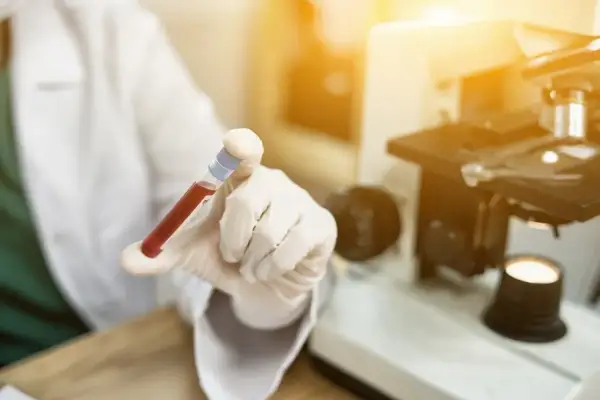 Podwyższone RDW-CV: co oznacza dla twojego zdrowia i diagnozy?