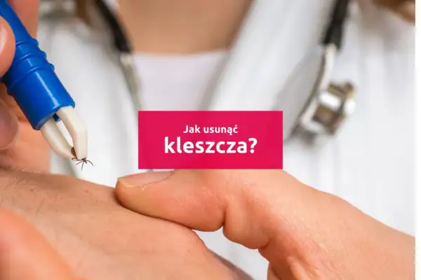 Usuwanie kleszcza specjalnym przyrządem. Tekst: "Jak usunąć kleszcza?".
