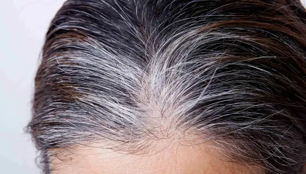 Gros plan sur des cheveux mi-bruns, mi-blancs. Un temps de pause coloration cheveux blancs est peut-être en cours, laissant apparaître des mèches argentées naturelles.