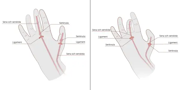 Illustrationer visar handens olika delar: senor, senskidor, ligament och senknutor.