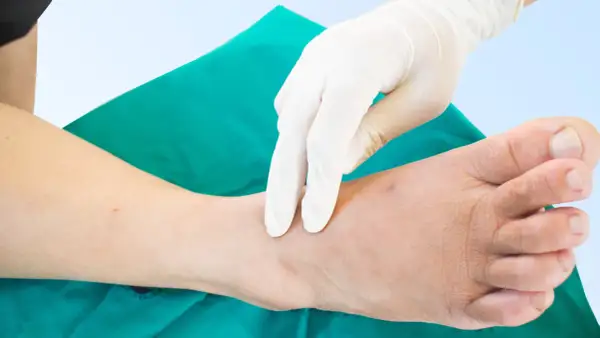 Mano guantata esegue un massaggio per la fisioterapia per neuropatia arti inferiori, concentrandosi sulla caviglia e sul piede.