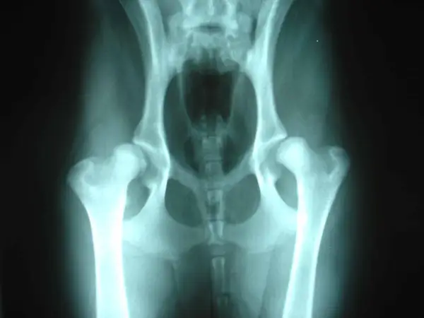 Radiografía de cadera de perro mostrando signos de displasia de cadera, una condición común en perros.