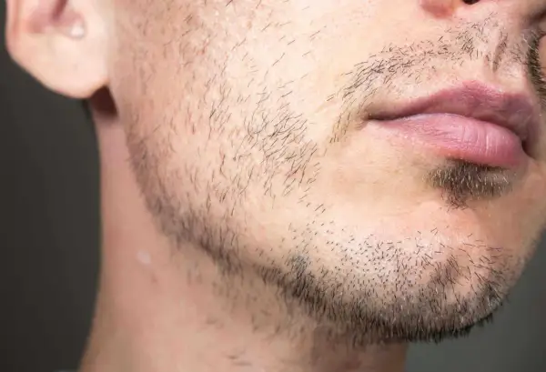 Un homme de 25 ans avec une barbe clairsemée et des lèvres roses. Il a une petite cicatrice sur la joue.