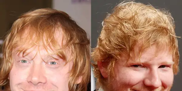 Czy Ed Sheeran grał w Harrym Potterze? Prawda o jego udziale