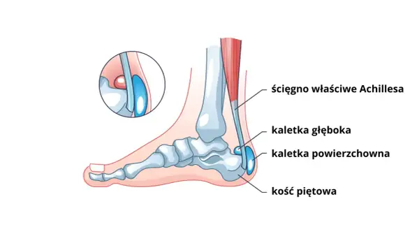Anatomia pięty: ścięgno Achillesa, kaletki i kość piętowa.