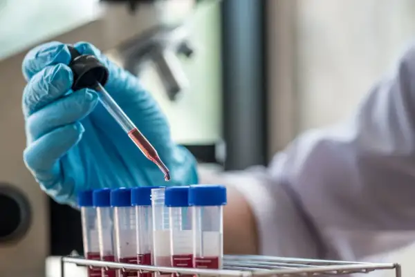 Ile kosztuje test na HIV w laboratorium? Sprawdź ceny i opcje darmowe