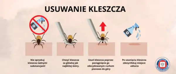Jak bezpiecznie usunąć kleszcza? Sprawdzony poradnik krok po kroku
