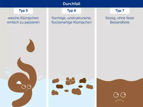 Durchfall: Typ 7 zeigt flüssigen, hellbraunen Stuhl wie Wasser, ohne feste Bestandteile.