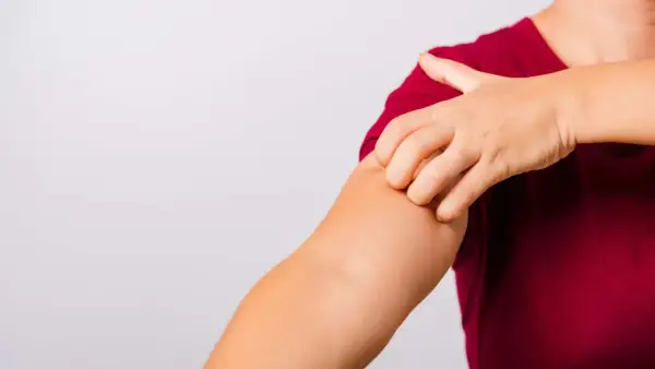 Eine Hand kratzt sich am Arm. Vielleicht hilft **Essig gegen Juckreiz**?