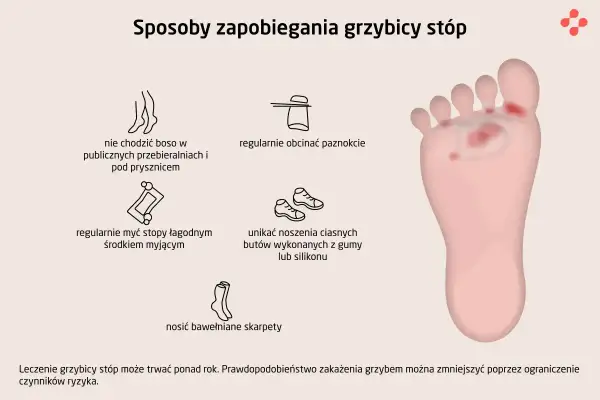 Ilustracja pokazuje sposoby zapobiegania grzybicy stóp: nie chodzić boso, myć stopy, obcinać paznokcie, unikać ciasnych butów, nosić bawełniane skarpety.
