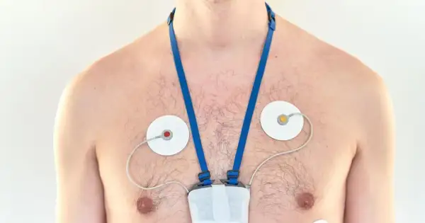Mężczyzna z przyklejonymi elektrodami i urządzeniem na klatce piersiowej, monitorującym jego serce. To holter ciśnieniowy.
