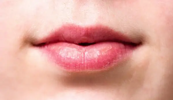 Nahaufnahme von Lippen. Trockene Lippen können ein Zeichen dafür sein, dass der Speichelfluss nachts angeregt werden muss.