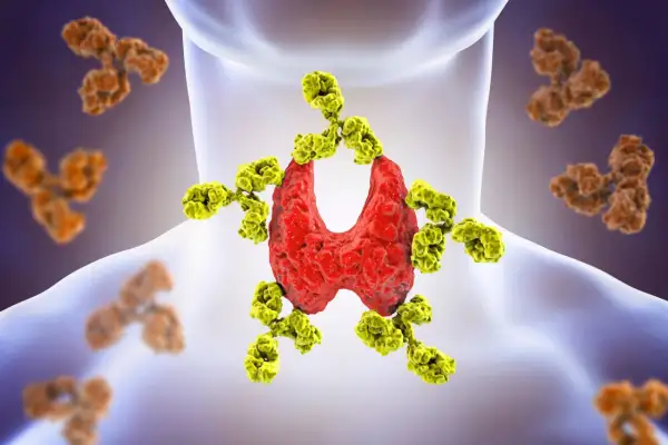 Tarczyca atakowana przez żółte przeciwciała, ilustracja chorób autoimmunologicznych.