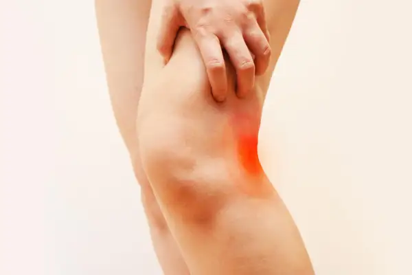 Dolore dietro al ginocchio dopo corsa, con un'area rossa che indica l'infiammazione.
