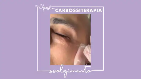 Close-up of a needle injecting into the under-eye area, with text overlay "CARBOSSITERAPIA".