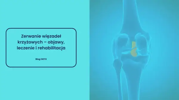 Ilustracja przedstawia zerwane więzadło krzyżowe w kolanie. Czy zerwane więzadło boli? Dowiedz się o objawach, leczeniu i rehabilitacji.