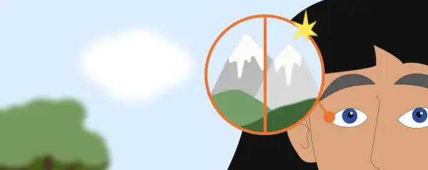 Occhi che osservano montagne, una sfocata, l'altra nitida, forse un problema al neurite ottica.