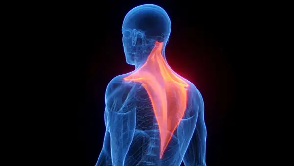 Vue anatomique du dos humain, mettant en évidence les muscles trapèzes en rouge vif, symbolisant la douleur trapeze.
