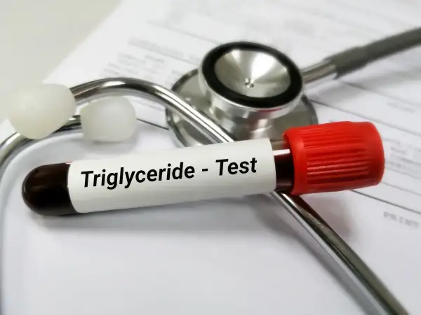 Probówka z krwią do badania trójglicerydów leży na stetoskopie. Wysokie trójglicerydy mogą wpływać na samopoczucie.