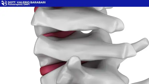 Dettaglio anatomico della colonna vertebrale, con dischi intervertebrali rossi tra le vertebre bianche. Illustra la potenziale area di interesse per la lordosi cura.