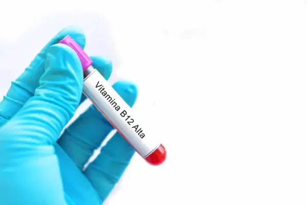 Guanto blu tiene provetta con etichetta "Vitamina B12 Alta". Risultato di analisi del sangue.