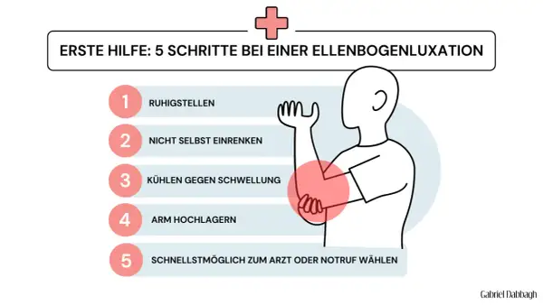 Erste Hilfe bei einem ellenbogen ausgekugelt: Ruhigstellen, nicht selbst einrenken, kühlen, Arm hochlagern, Arzt rufen.