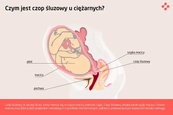 Ilustracja przedstawia przekrój przez ciążową macicę z płodem. Widoczny jest czop śluzowy zamykający szyjkę macicy.