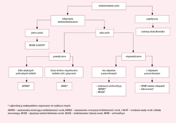 Schemat diagnostyczny torbieli nerek: od pojedynczej do wielotorbielowatości, z podziałem na objawy i lokalizację.