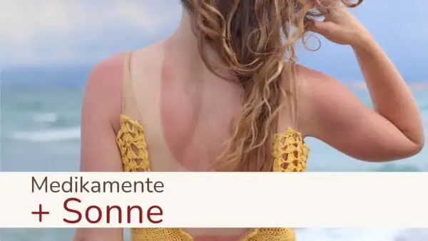 Sonnenbrand am Rücken einer Frau, die Medikamente einnimmt. Vorsicht bei Antibiotika und Sonne!