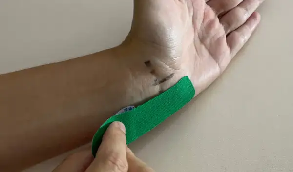 Hand mit grünen Tape, das auf das Handgelenk geklebt wird, um Taubheitsgefühl im kleinen Finger zu lindern.