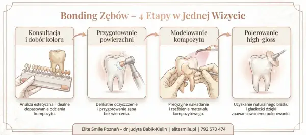 Bonding zębów: konsultacja, przygotowanie, modelowanie kompozytu i polerowanie. Zabieg nie niszczy zębów, a jedynie je upiększa.