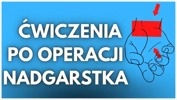 Jakie ćwiczenia po zabiegu cieśni nadgarstka pomogą w szybkiej rehabilitacji