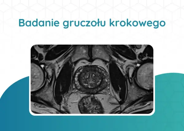 Tomografia prostaty: przekrój przez miednicę ukazujący gruczoł krokowy, pęcherz moczowy i inne struktury.