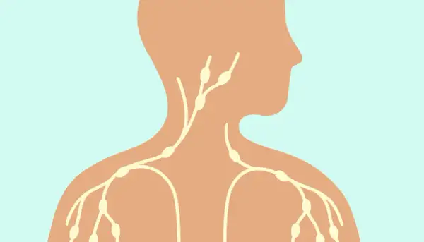 Schéma du système lymphatique montrant des ganglions dans le cou, qui peuvent être un ganglion cou douloureux au toucher.