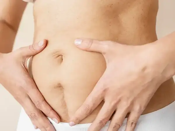 Dłońmi obejmuje brzuch, ukazując bliznę pooperacyjną, która zaczyna się goić.