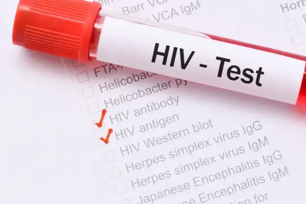 Próbówka z krwią do testu HIV. Zaznaczone "HIV antibody" i "HIV antigen". Wczesne wykrycie objawów HIV jest kluczowe.