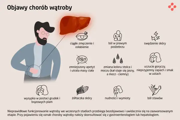 Ilustracja przedstawia objawy chorób wątroby, m.in. zmęczenie, ból w prawym podżebrzu, swędzenie skóry, nudności i wymioty. Wzw C może objawiać się podobnie.